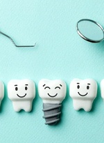 cartoon model of a dental implant between natural teeth 