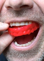 man putting a red mouthguard in his mouth 