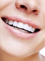 Closeup of smile after cosmetic dentistry