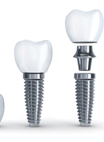 X-ray of a person with a dental implant in Norwood 