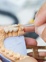 dental bridge being made by dentist   