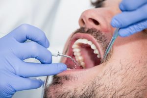 man getting plaque removed at dentist's office