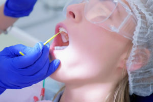 woman receiving fluoride treatment at dentist