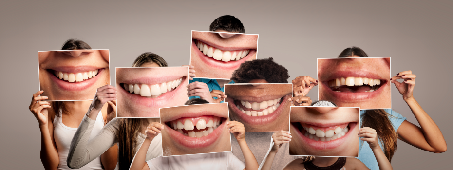 People holding photos over their smiles of close up smiles/teeth